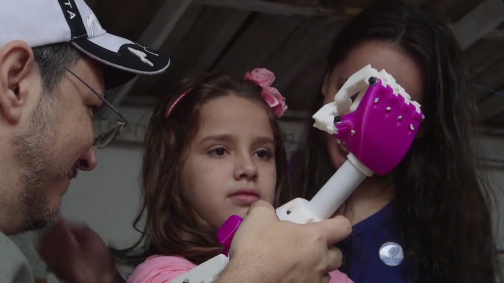 The Cure - 3D-Printed Prosthetics