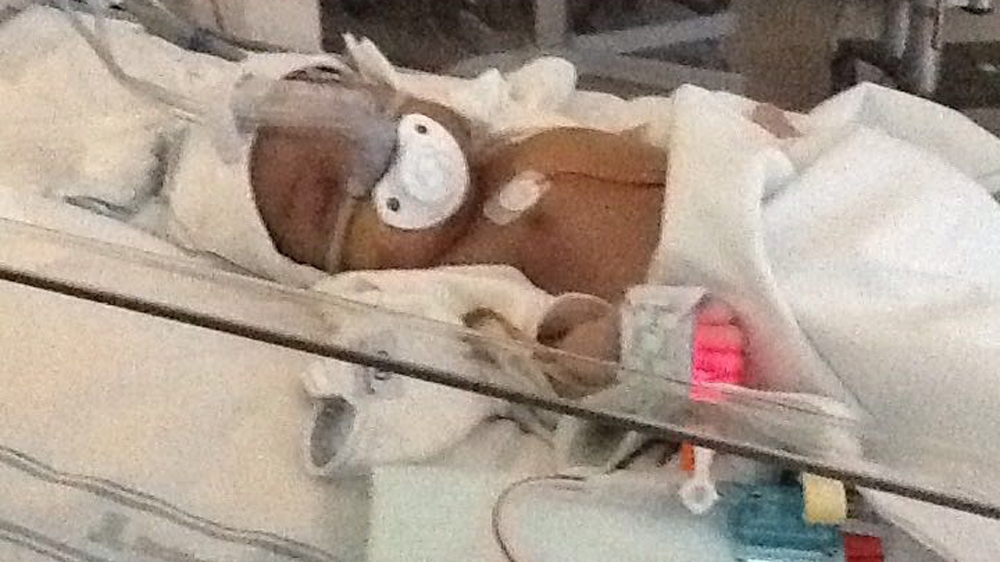 Noor spent 10 days in intensive care before she had her open heart surgery. She was six days old when this photo was taken [Fatma Naib photo]