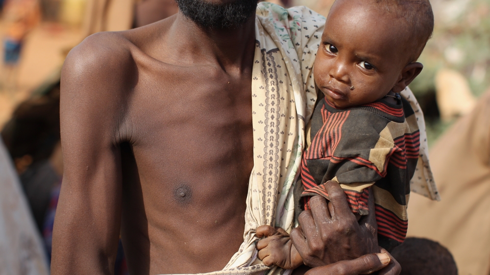 In Central and East Africa, about 12 percent of women and 15 percent of men are underweight [Getty Images]