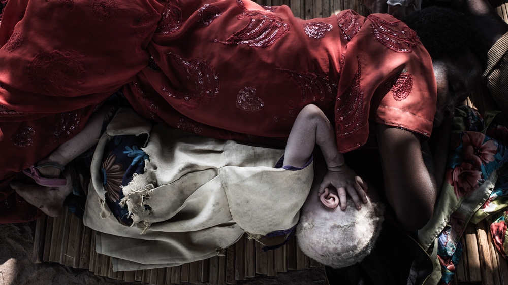 Florence and her daughter Naburja rest after dinner in the shade. Naburjas vision is very weak, and around midday, it's hard for her to see anything [Fredrik Lerneryd/Al Jazeera]