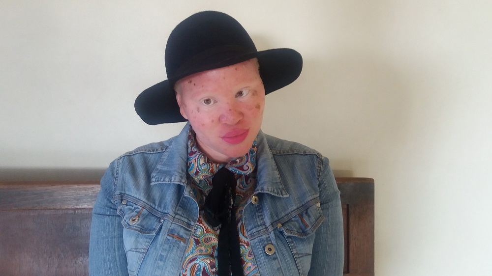 World Albinism Day