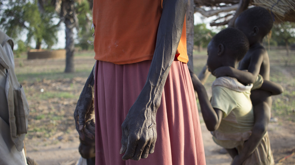 Many of the villagers of Kanjak are already starving [Henry Wilkins/Al Jazeera]