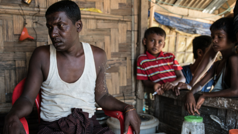 Fisherman Abdu Jolil weeps as he recounts an attack by the Myanmar navy the previous night. Thanaka was applied to his left arm to soothe the pain [Katie Arnold/Al Jazeera]