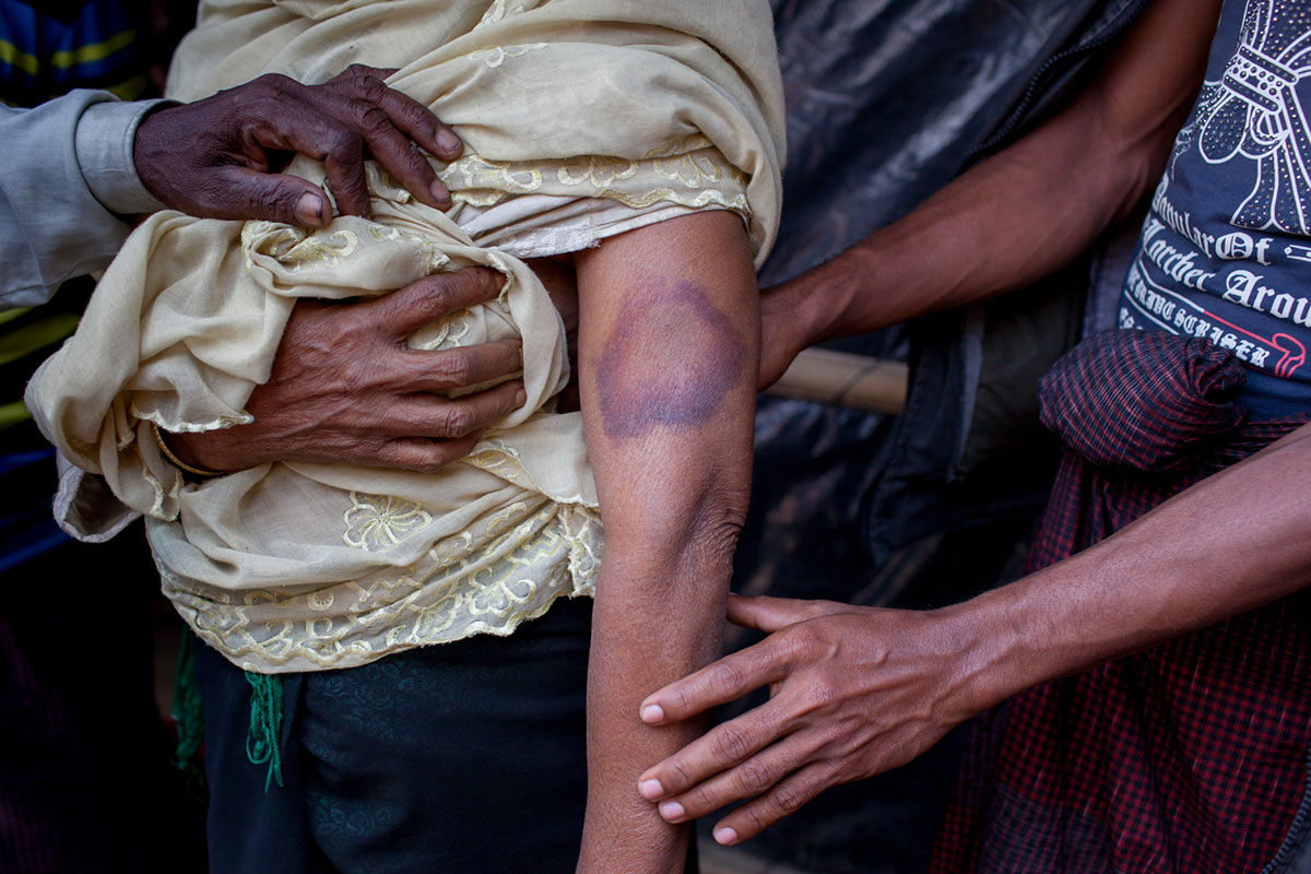 Rohingya in Bangladesh / Please Do Not Use