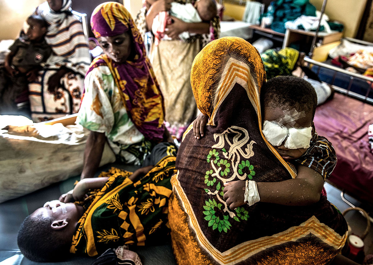 The fight for sight - Bakir’s Journey/ Please Do Not Use