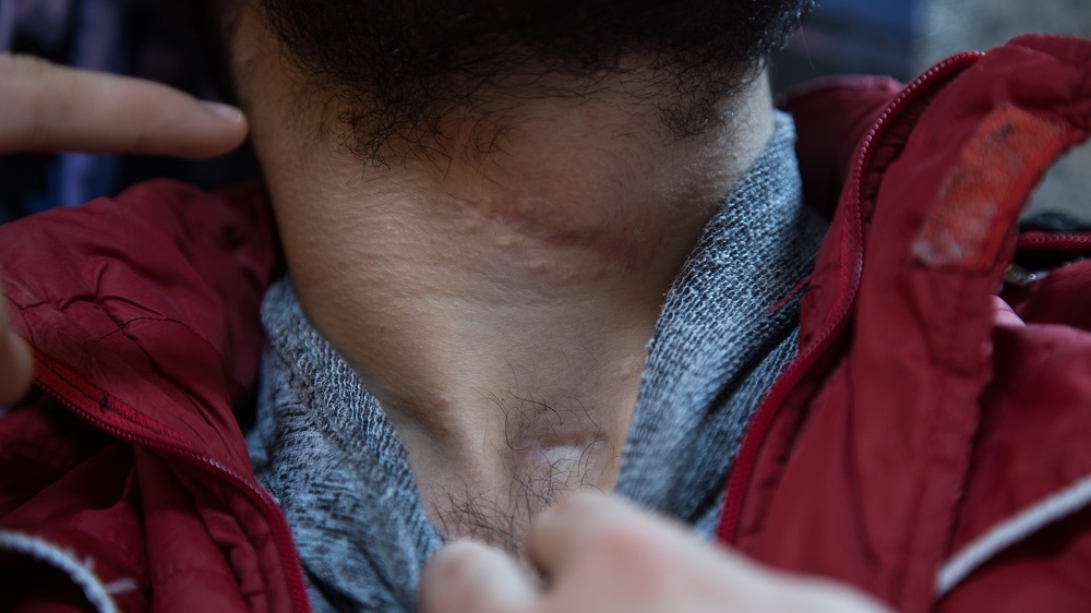 Kaddour was shot 13 times by government soldiers during a botched attack against Free Syrian Army fighters with whom he was embedded [Baba Tamim/Al Jazeera]