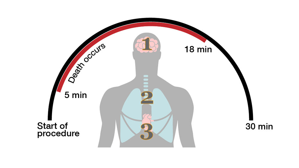 infographic how lethal injections work? outside image