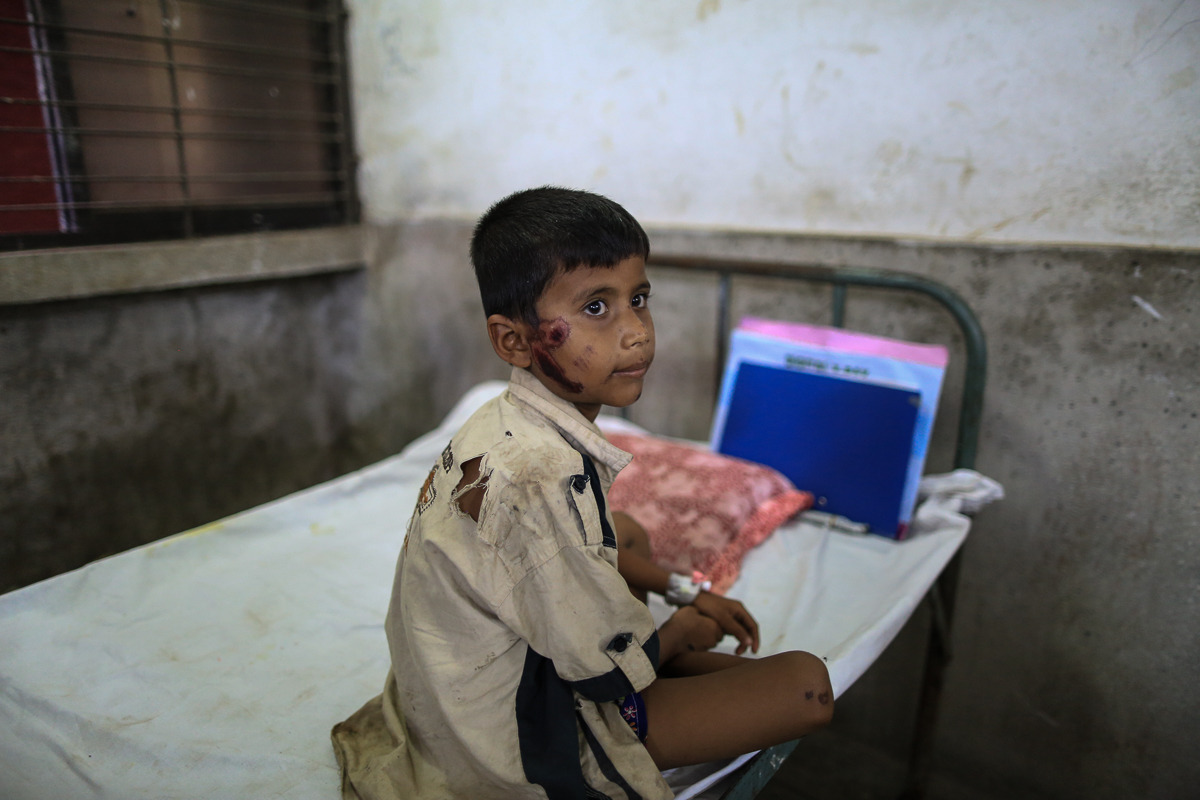 8-year old Mohammad Anas gets treated for his facial injuries, he received while fleeing the army after they had attacked his village. [Showkat Shafi/Al Jazeera]