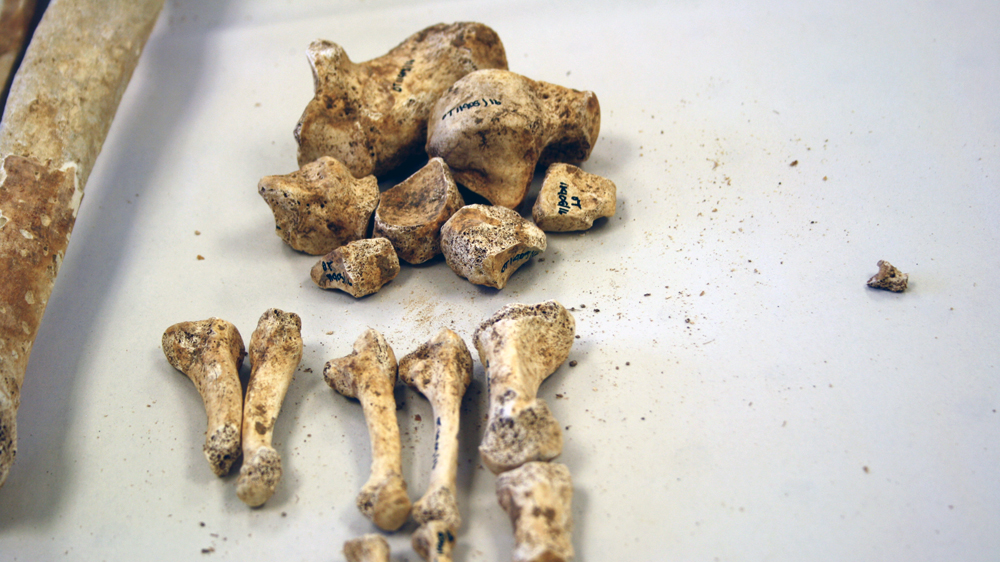 All bones are labelled to maintain the chain of custody during medical forensic examinations [Chantal Flores/Al Jazeera]