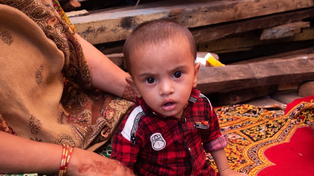 The small diameter of this 18-month-old boy’s arms and legs reveals that like many children in Shivaji Nagar, he too is malnourished