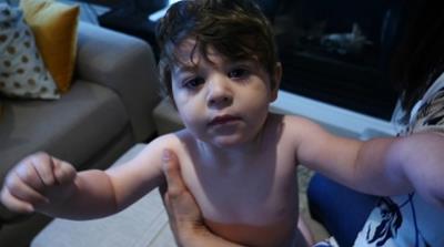 Rare Diseases 6