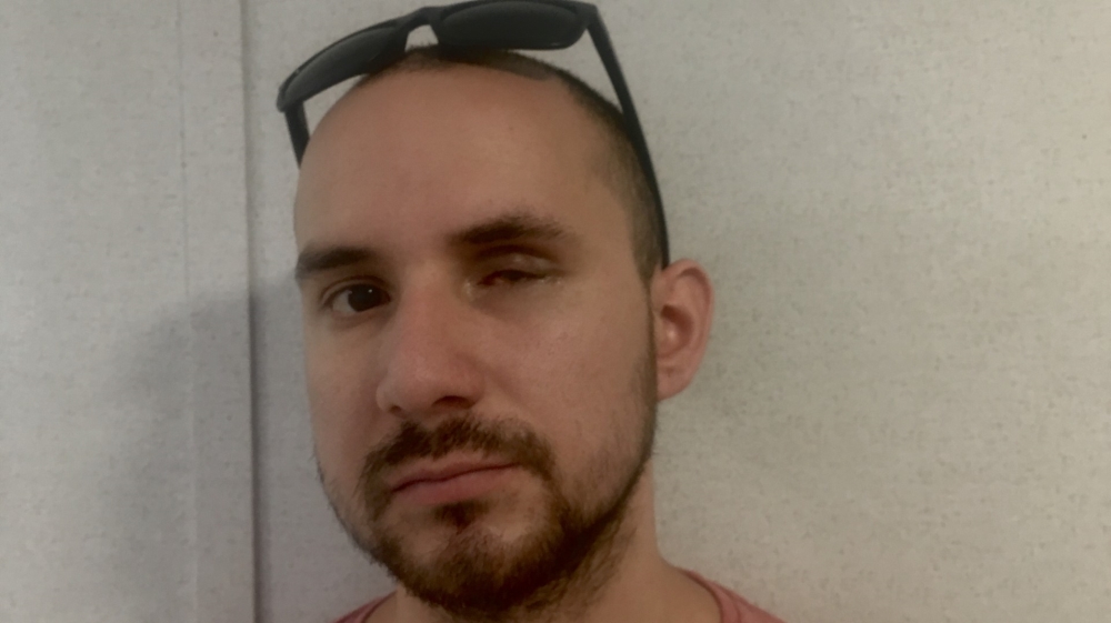 Christopher Rodrigo, 24, left his house to attend a protest last year and was hit in the eye by a rubber bullet, changing his life forever
