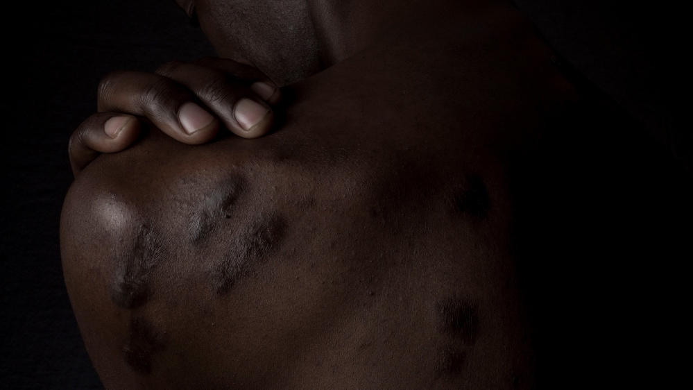 Congo rape survivors / Sarah Thust