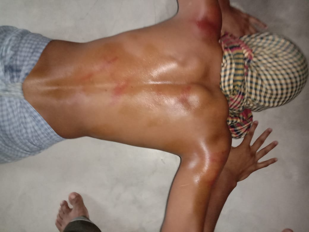 Photographs of men wounded by the beatings were provided to Al Jazeera by Rohingya activists who did not want to be named, fearing official retribution [Al Jazeera]