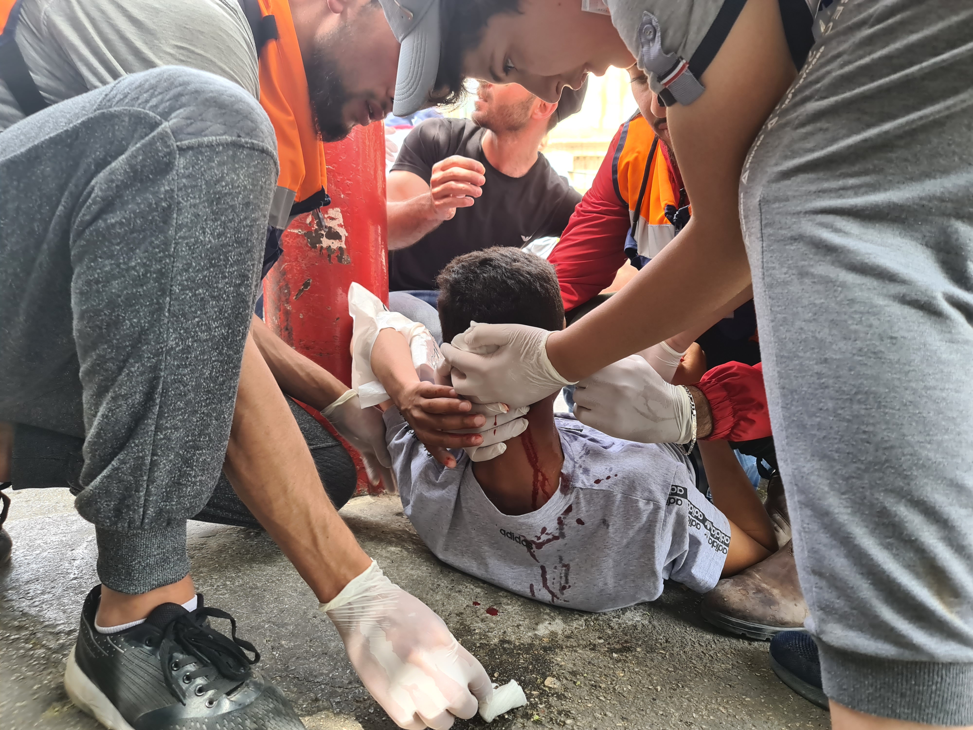 A young Palestinian man is treated after being struck by a rubber-coated bullet in the back of the head [Ibrahim Husseini/Al Jazeera]