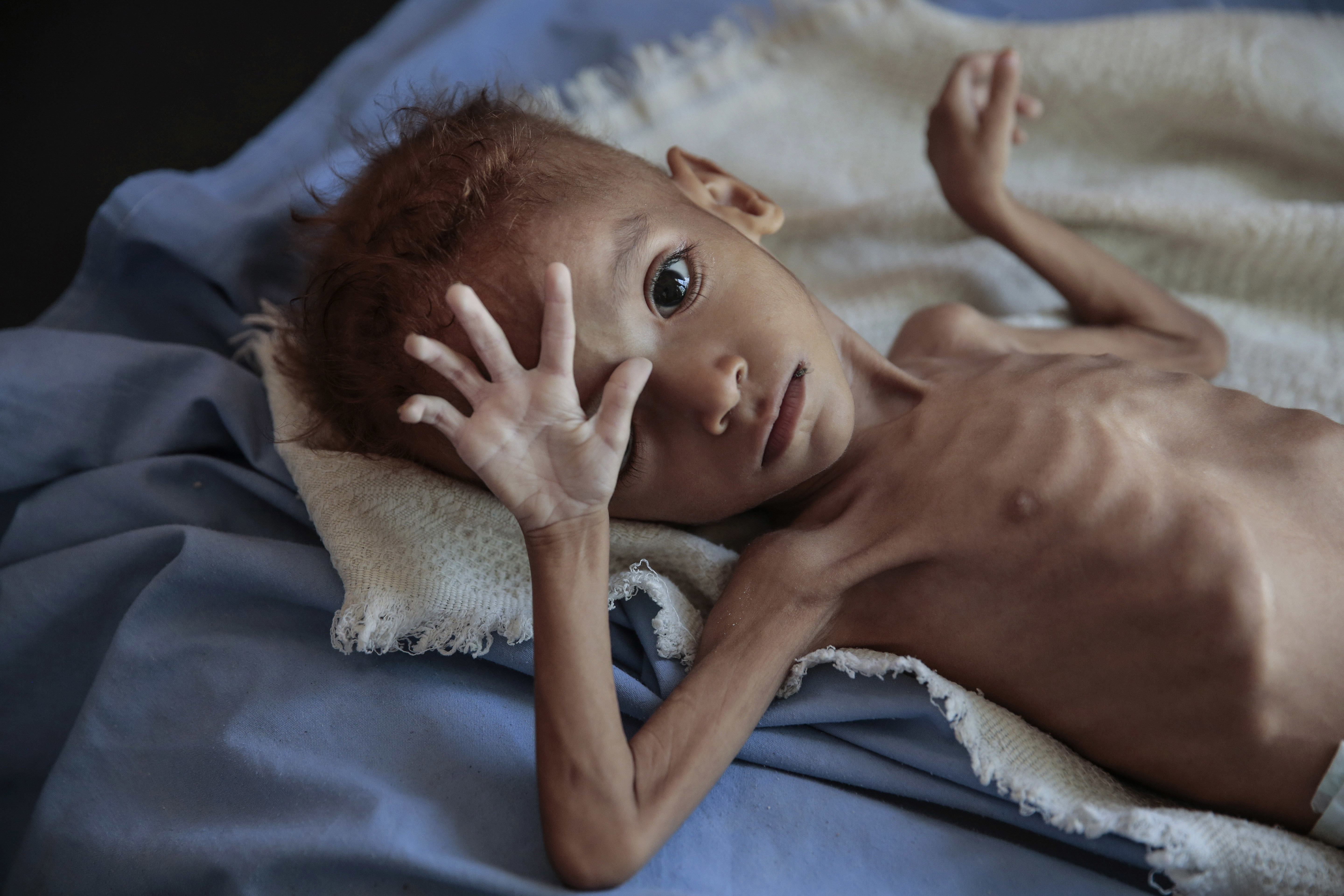 The UNDP report projected the number of people experiencing malnutrition would surge to 9.2 million by 2030