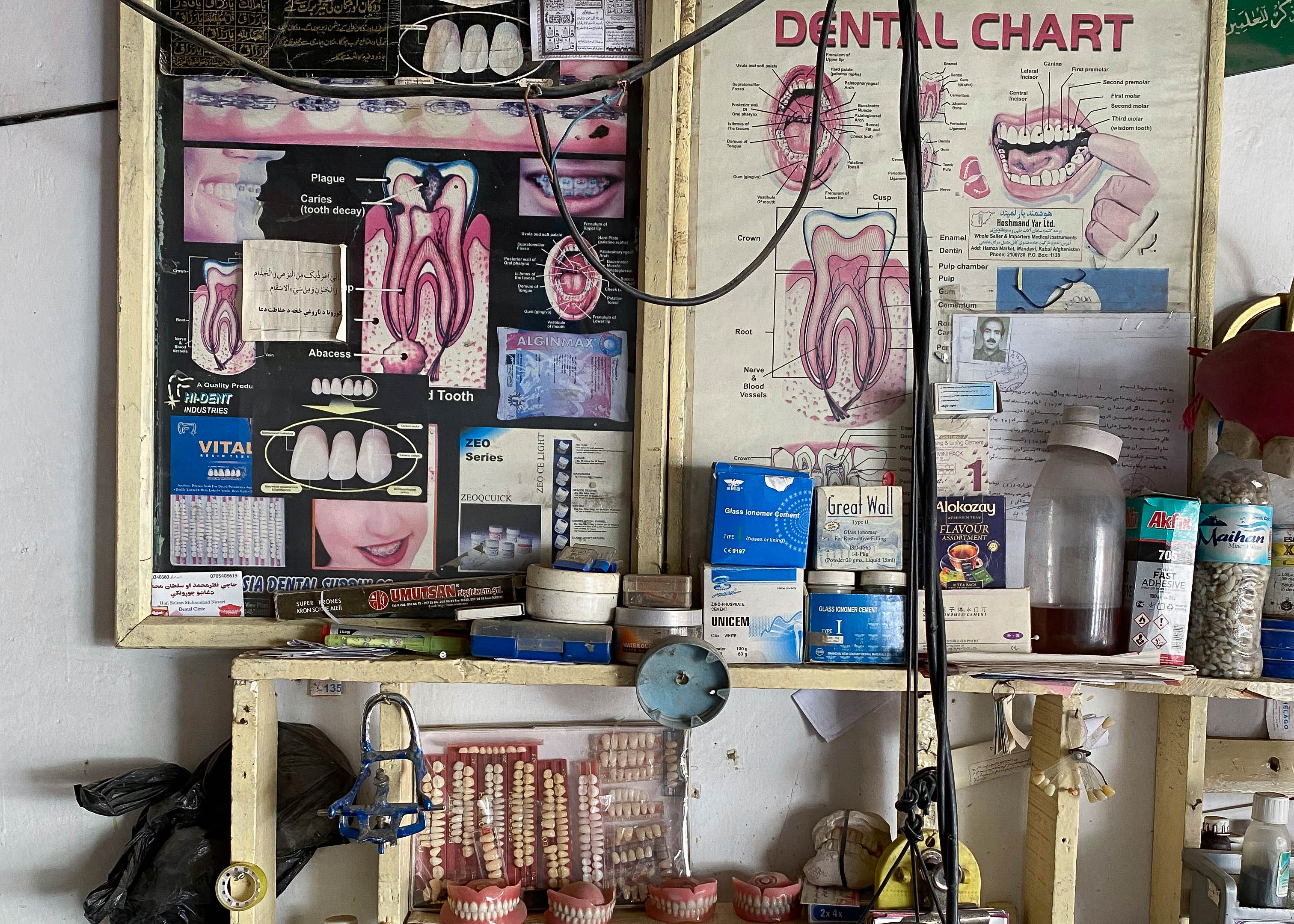 A photo of a shelf with samples of different dentures and two posters on a wall with diagrams for teeth.