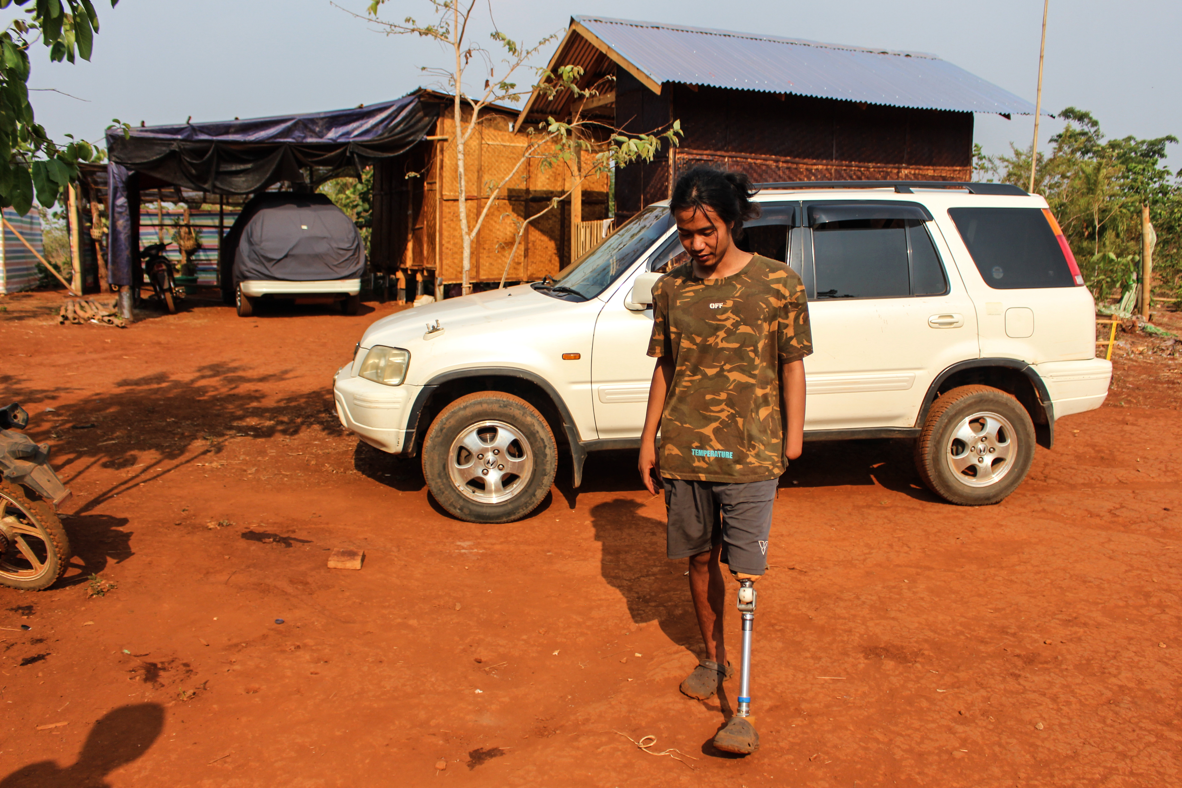KNDF fighter Philip Lin Maung, 21, spent four months in hospital after losing part of his leg and arm when Myanmar military shells landed by his feet
