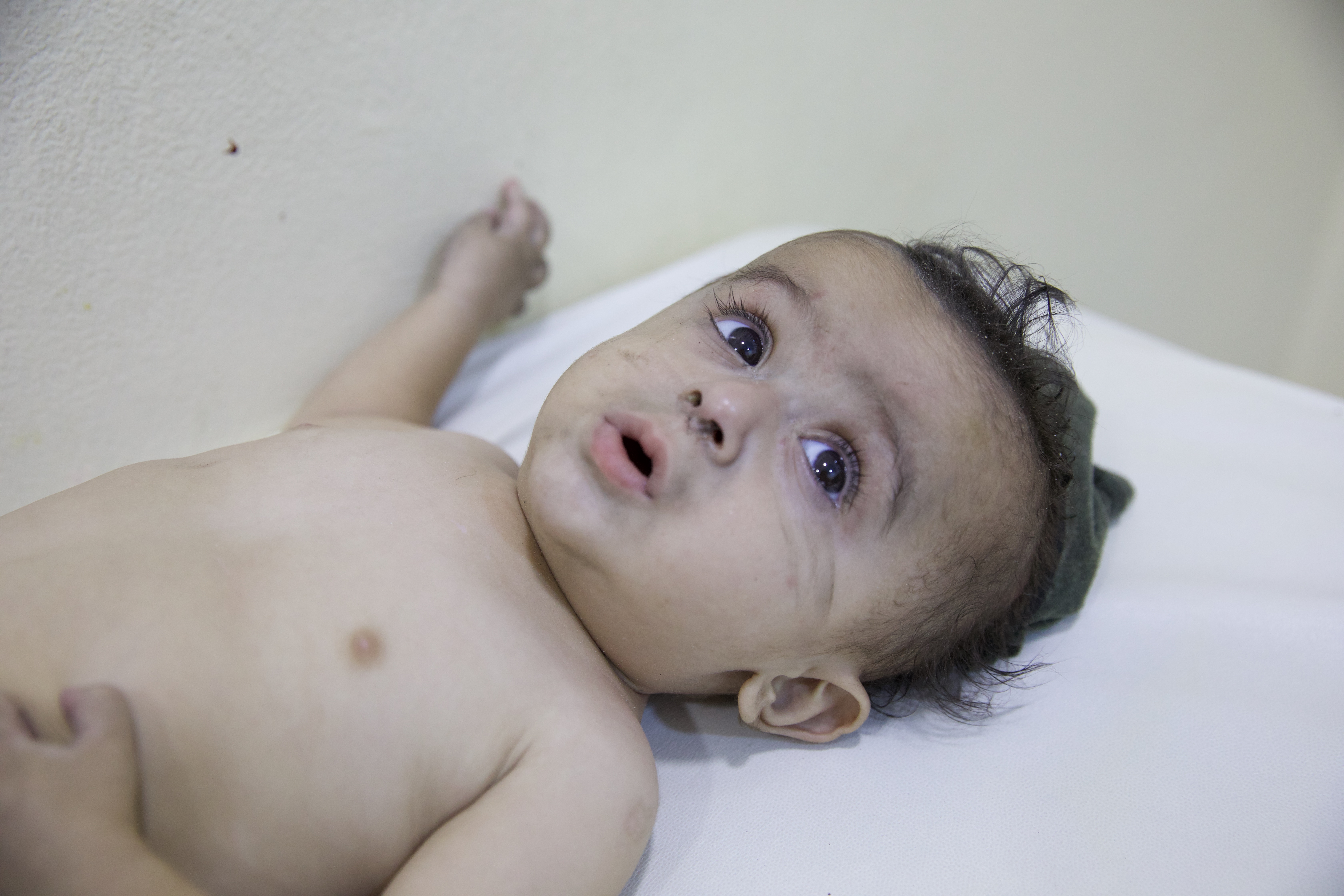 Baby on a hospital bed