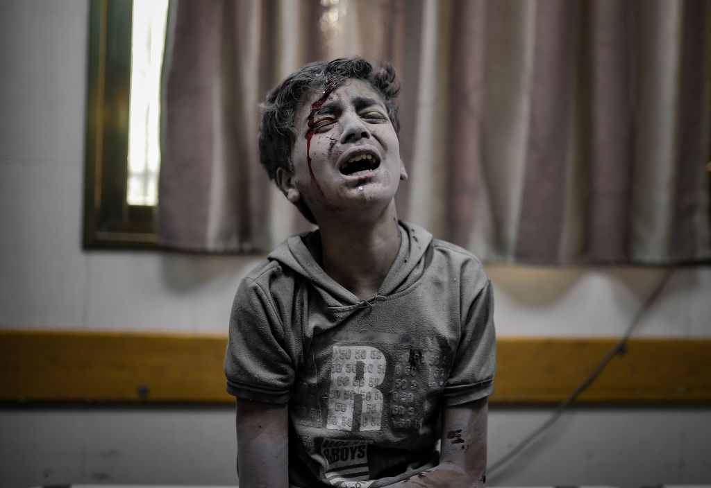 An injured boy cries at a hospital as the Israeli attacks continue on its 32nd day in Deir Al-Balah, Gaza.