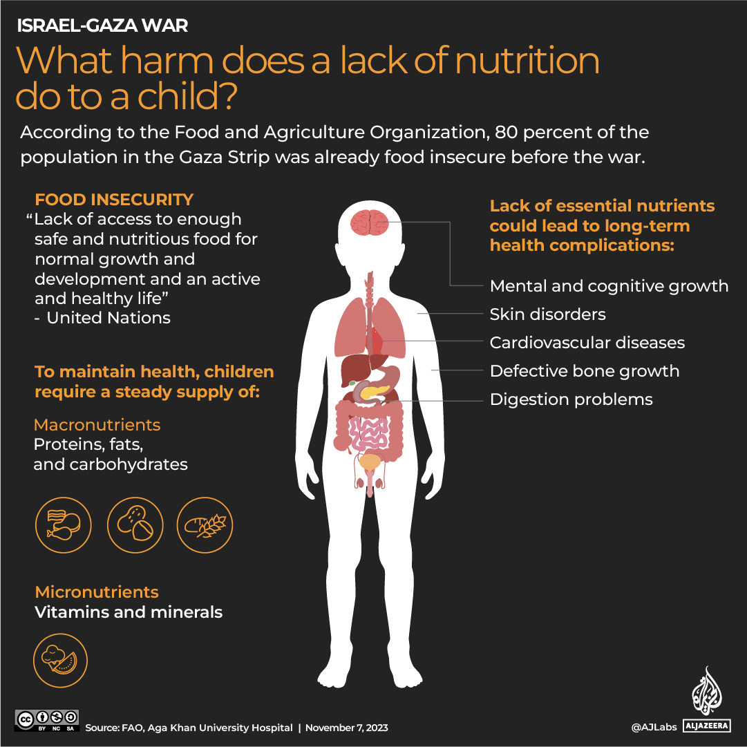 INTERACTIVE_NUTRITION_GAZA_NOV7_2023-1699368972