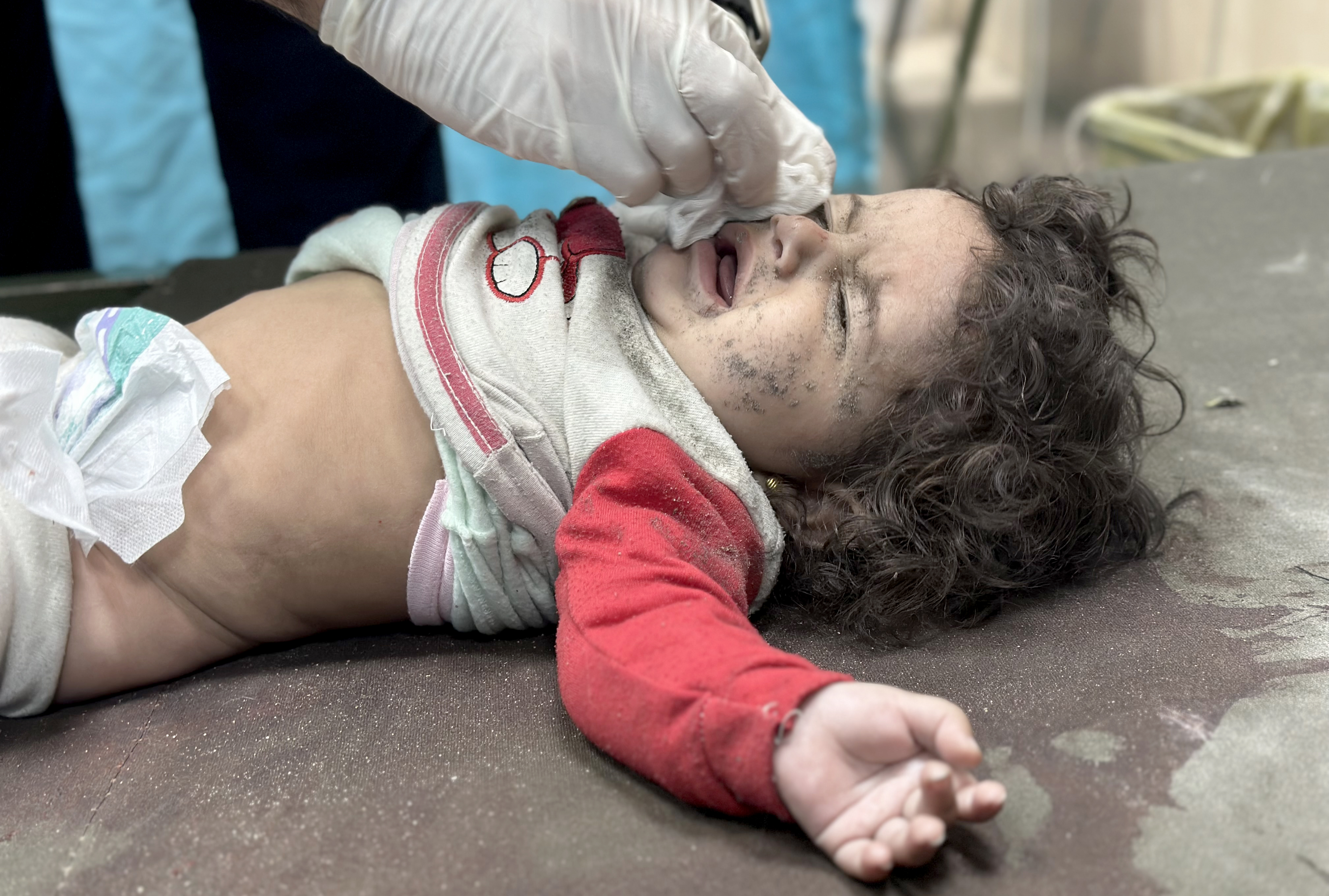 2-year-old Palestinian baby Larin Hussein, injured due to Israeli attack, is brought to the Aqsa Martyrs Hospital in Deir Al-Balah, Gaza.