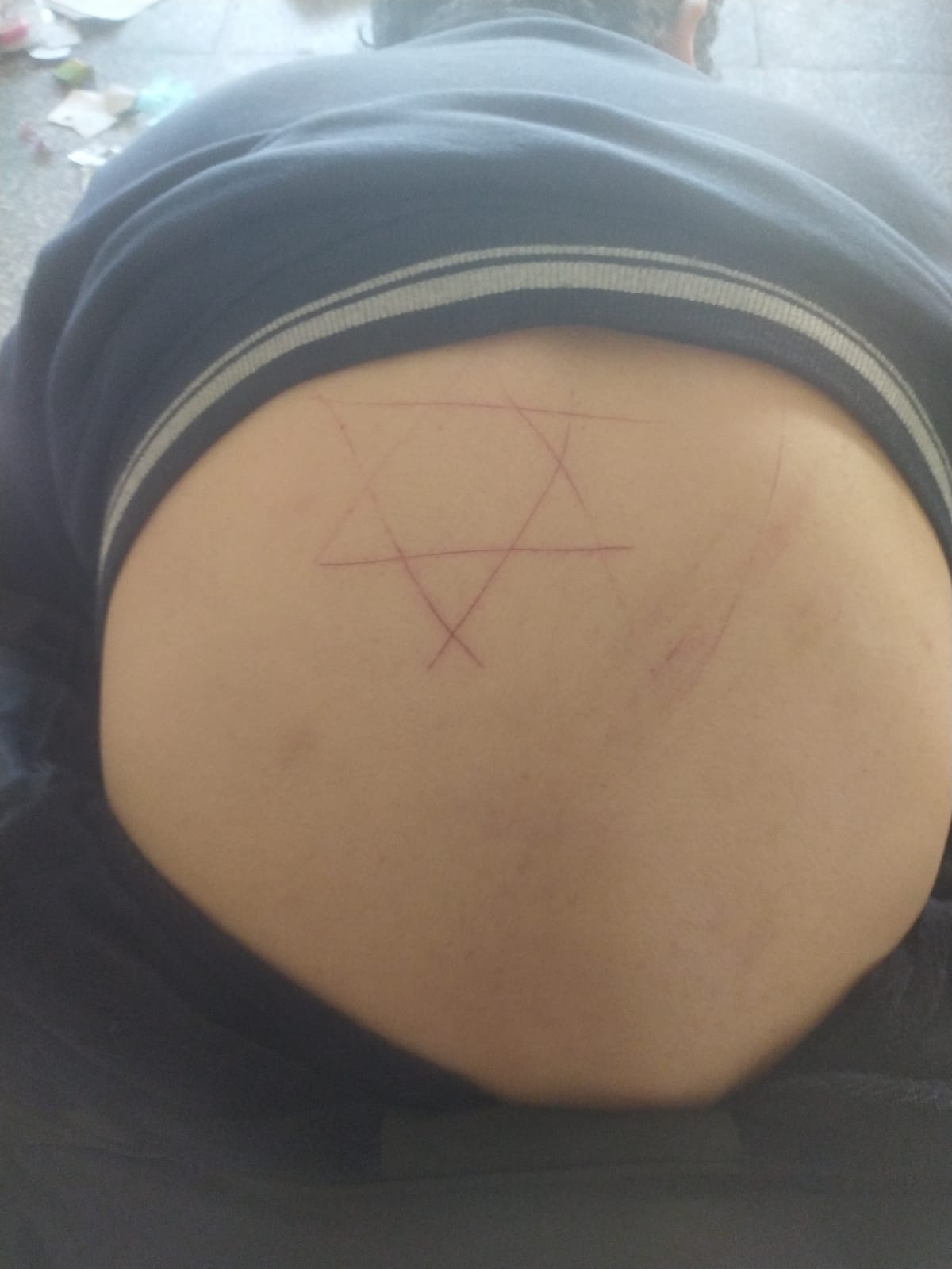 A photo of Hamad’s back with the Star of David cut into his back with a knife by an Israeli soldier [Courtesy of Susan Abulhawa]
