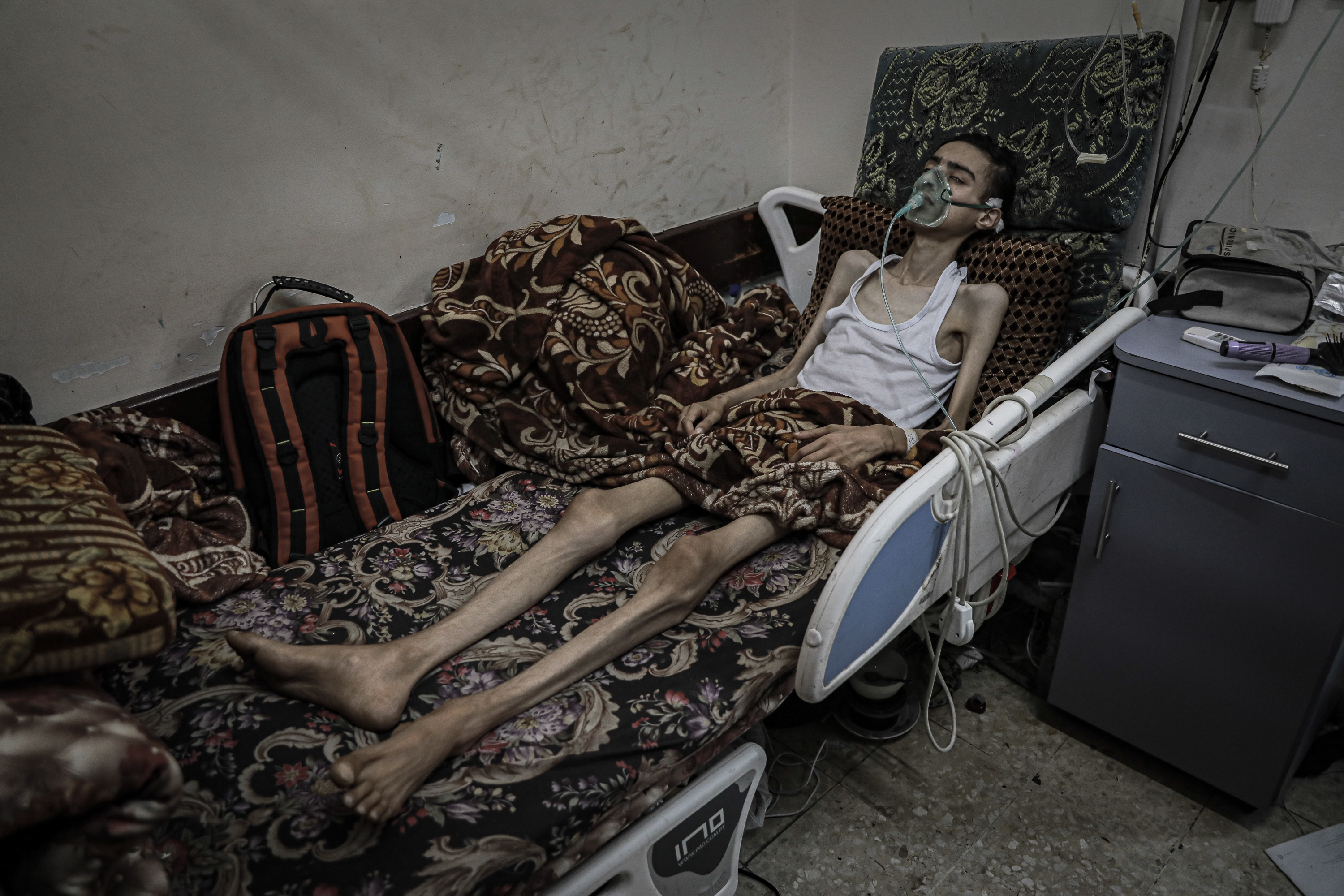 Abdul Majeed in his hospital bed, emaciated and struggling for breath, wholly dependent on the oxygen ventilator