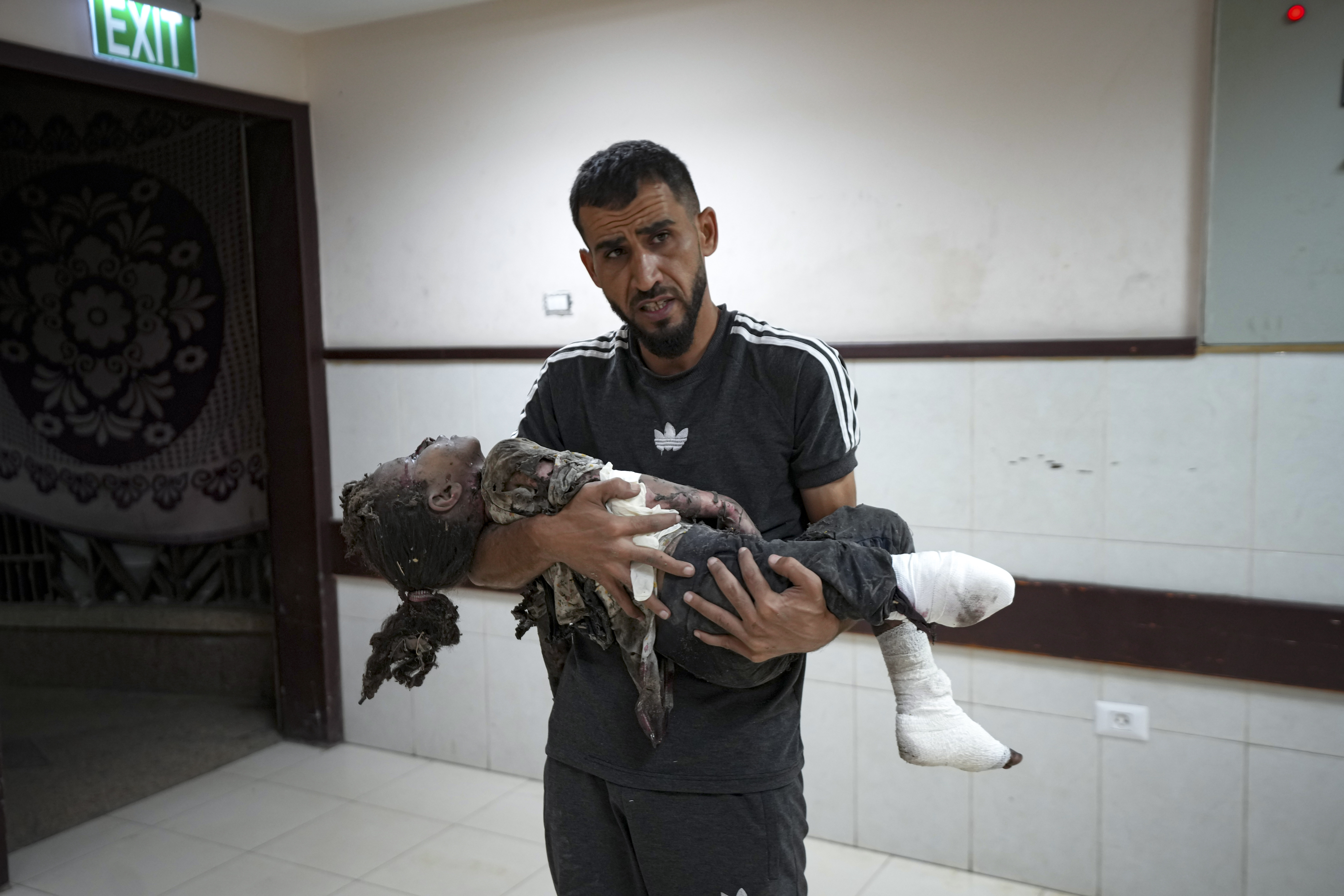A Palestinian man holds a child wounded in the Israeli bombardment of the Gaza Strip in a hospital in Deir el-Balah on Monday, September 30, 2024 [Abdel Kareem Hana/AP]