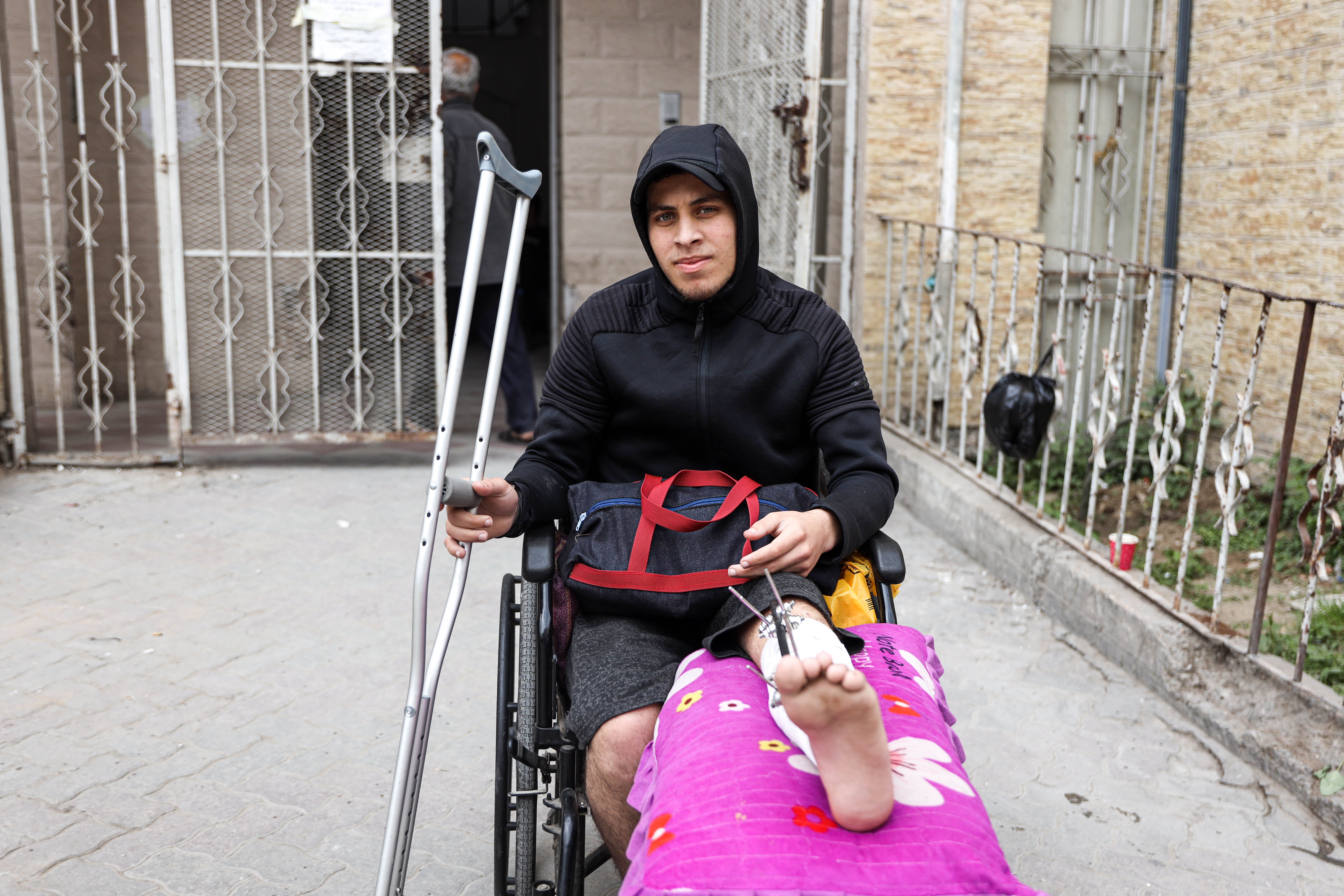 a mad in a wheelchair with screws and bolts holding his leg together