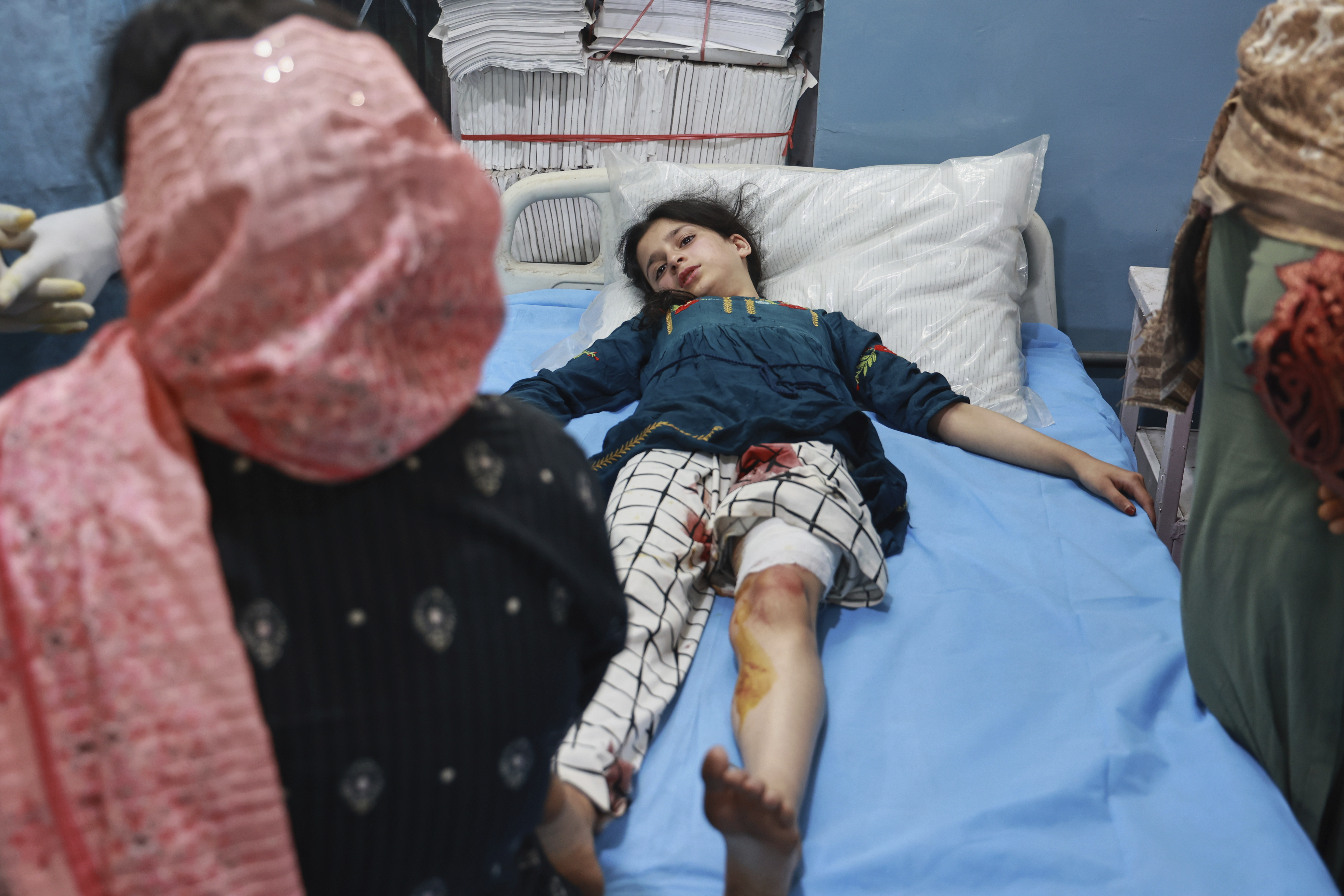 A girl who lives in a village near the Line of Control between India and Pakistan, and got injured during shelling by Pakistan gets treated at a hospital in Uri, Indian controlled Kashmir, Wednesday, May 7, 2025. (AP Photo/Nasir Kachroo)