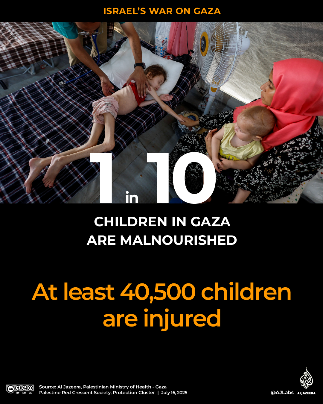 Interactive_Gaza_Children_report_July16_2025_Malnourished