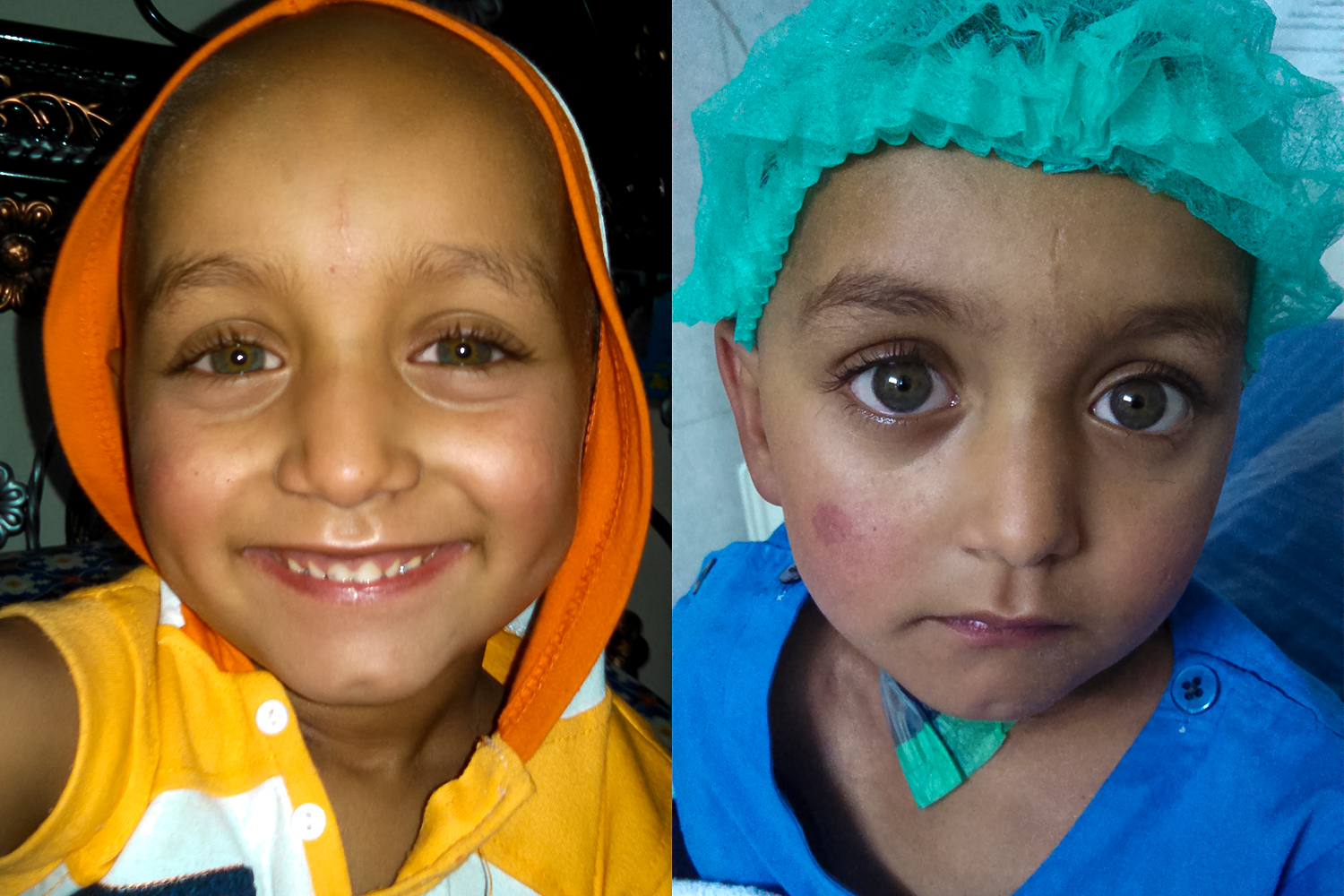 Mudassir Ali, diagnosed with thalassaemia major