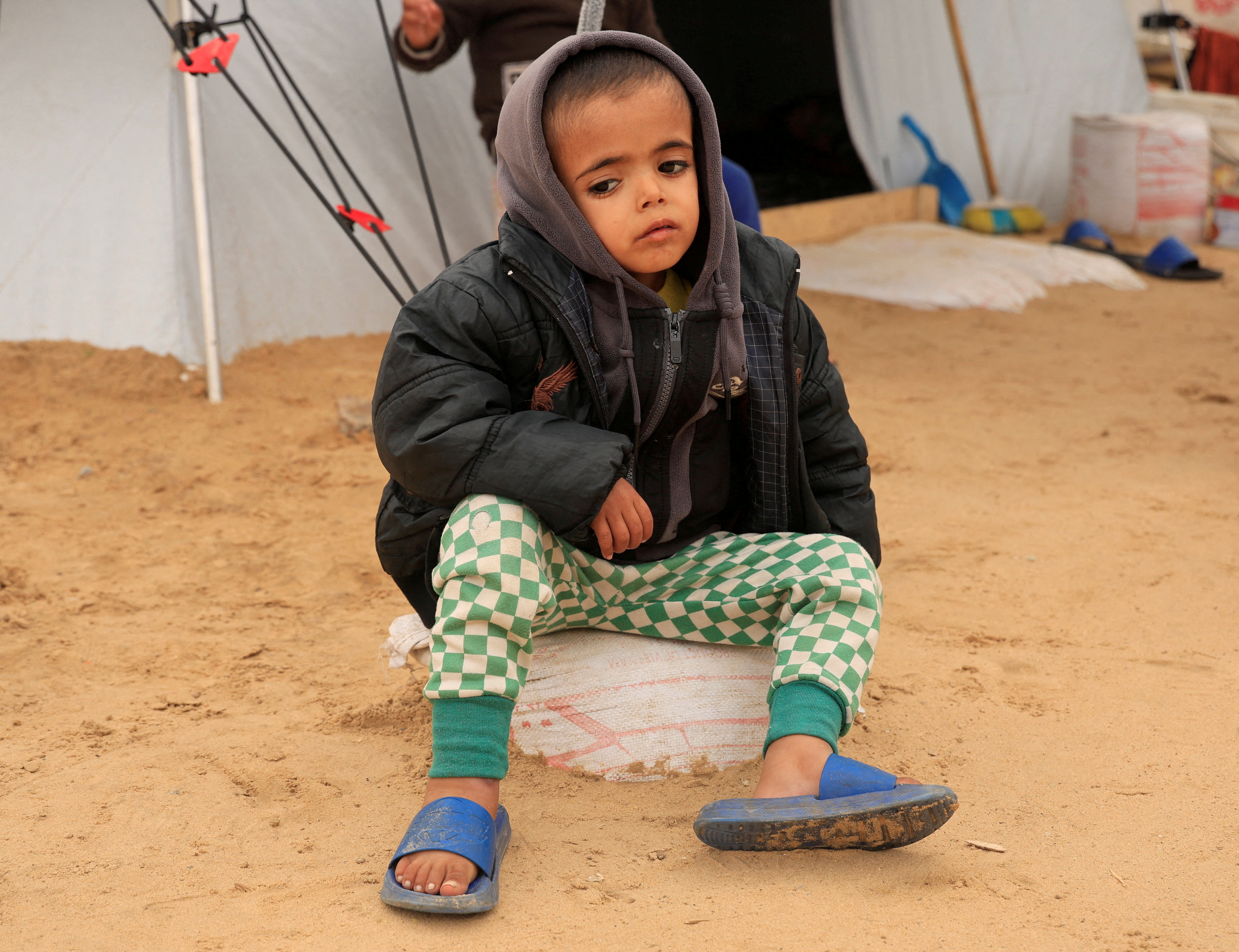 Displaced Palestinian child Yasser Arafat, 5, who, according to medics, suffers from severe acute malnutrition with nutritional edema, sits in front of his family's tent at a displacement camp in Khan Younis, southern Gaza Strip, December 16, 2025. REUTERS/Haseeb Alwazeer