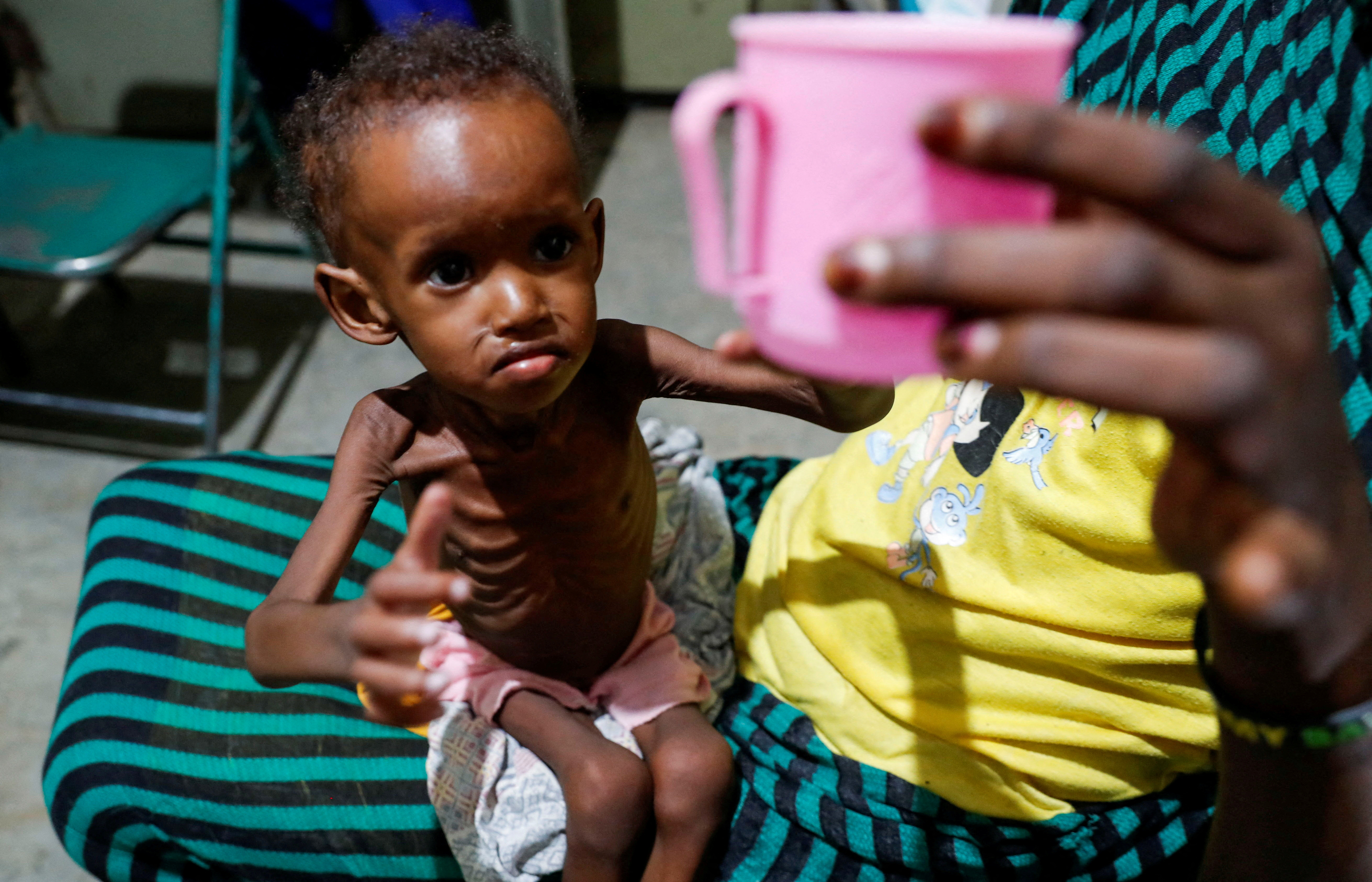 Saddam Najwa, a malnourished, 17-month-old internally displaced child