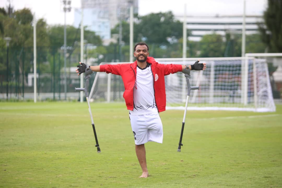 Man with amputated leg raises both arms