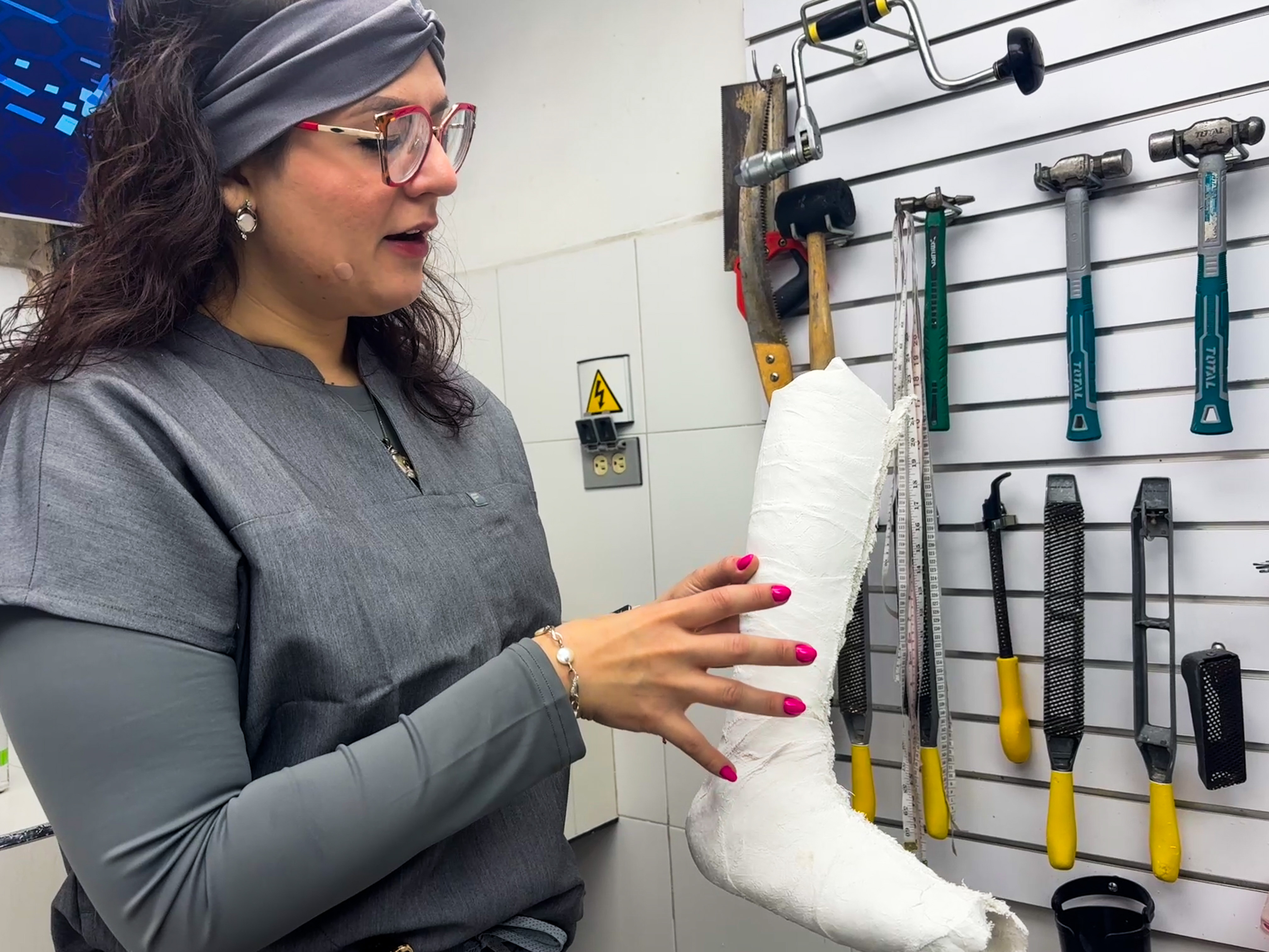 Bianca Damaso holds up a cast as she discusses how prosthetics are made and fitted